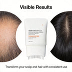 Hair Growth Serum