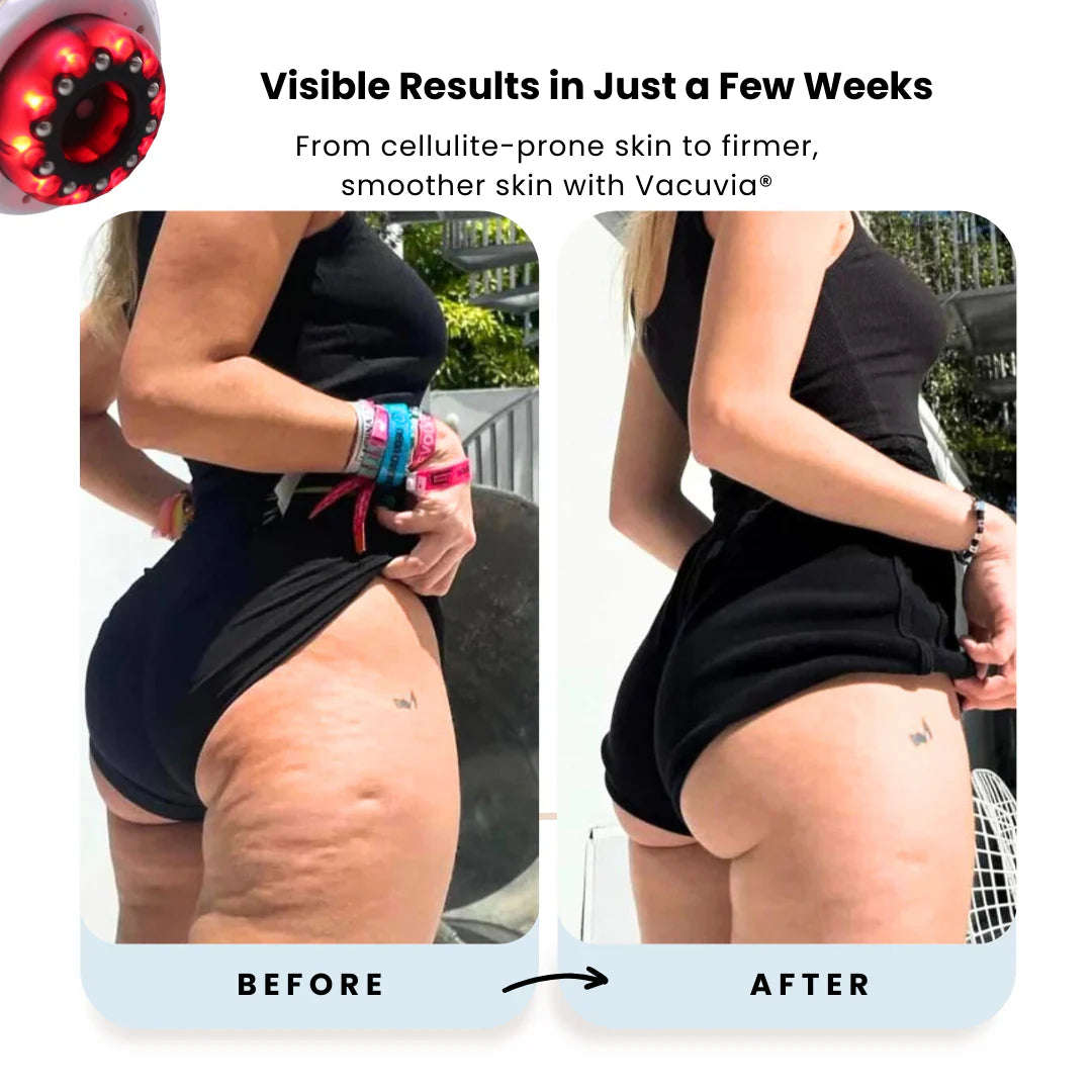 6/9 Gear Negative Pressure Vacuum Suction Cup Body Fat Burner Guasha Massage Home Rechargeable Electric Relief Cupping Massager